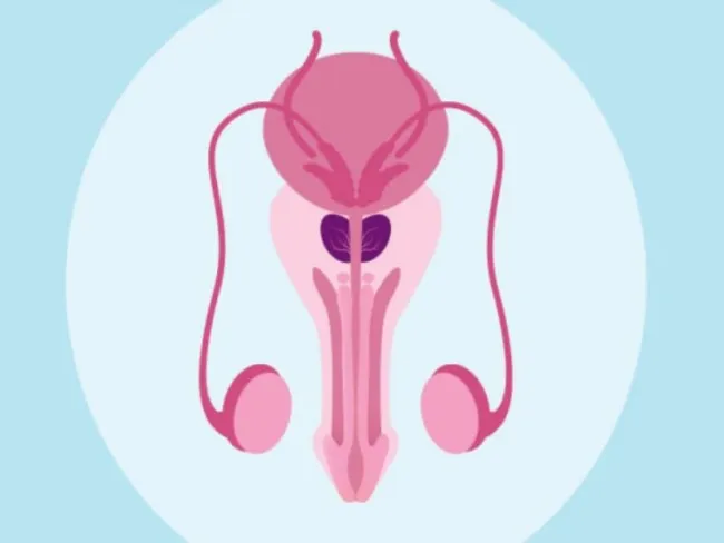 Cancer de prostată: afecțiune diagnosticată și la bărbații cu vârste cuprinse între 45 și 49 de ani