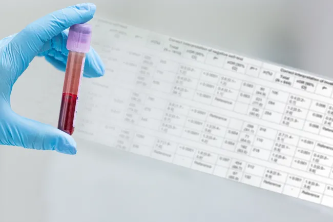 synevo centru de recoltare calarasi