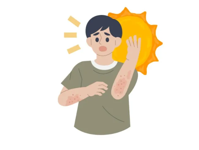 Alergie la soare: Cauze, Simptome, Tratament & Analize recomandate