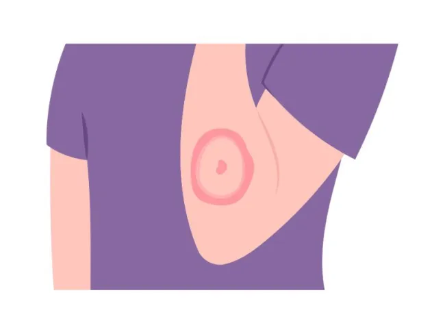 Informații utile despre “Parvovirus B19-Anticorpi IgG, IgM”