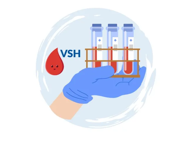 VSH mărit - Valori normale - Tratament pentru VSH crescut