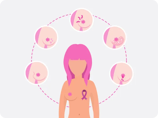Informații utile despre “CEA (Antigen carcinoembrionic)”