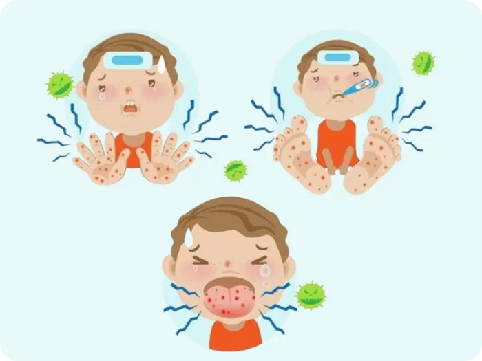 boala gura mana picior, boala mana gura picior, gura mana picior, gura mana picior copii