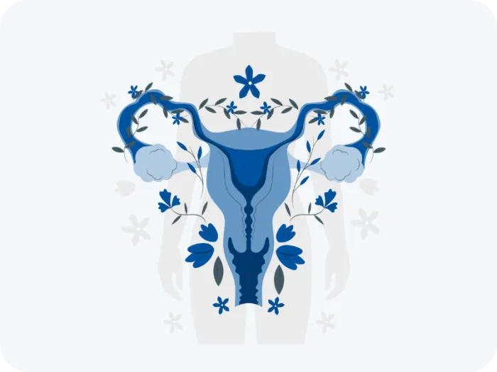 dureri de ovare, ovare polichistice, ovare, sindromul ovarelor polichistice, ovare micropolichistice