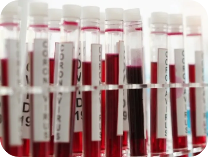 anticorpi igg covid-19